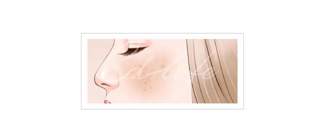 色斑皮肤问题及护肤解决方法,色斑护肤知识