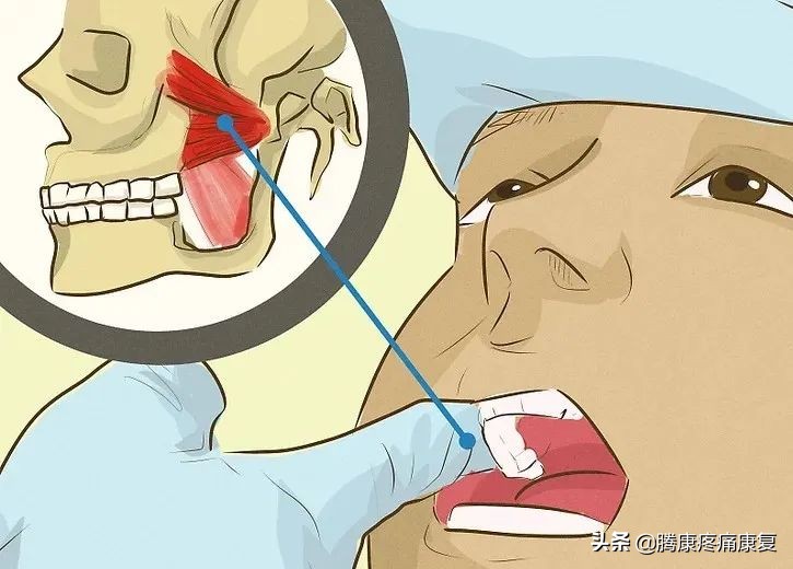 紧张性头痛怎么缓解,如何缓解紧张头痛和压力