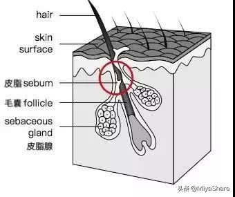 应该怎么正确对待黑头,什么办法才能真正解决黑头