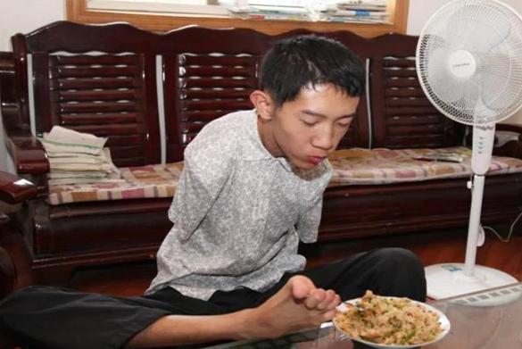 无臂少年彭超个人资料,无臂男孩彭超现状
