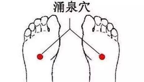 脚后跟干裂中医辨证及调理,脚后跟干裂的中医辨证治疗