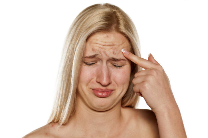 祛除疤痕痘印痘坑药膏,祛除痘印痘坑护肤品