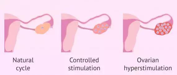 网上介绍代孕骗局,代卵代孕行业背后黑幕