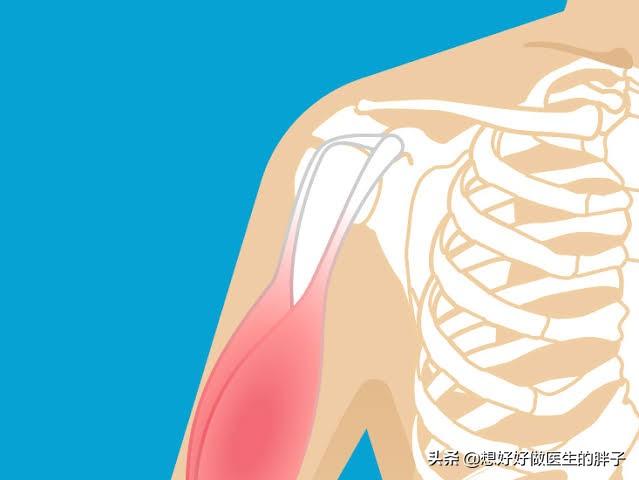 筋损伤怎么恢复最快最有效,筋是如何修复的