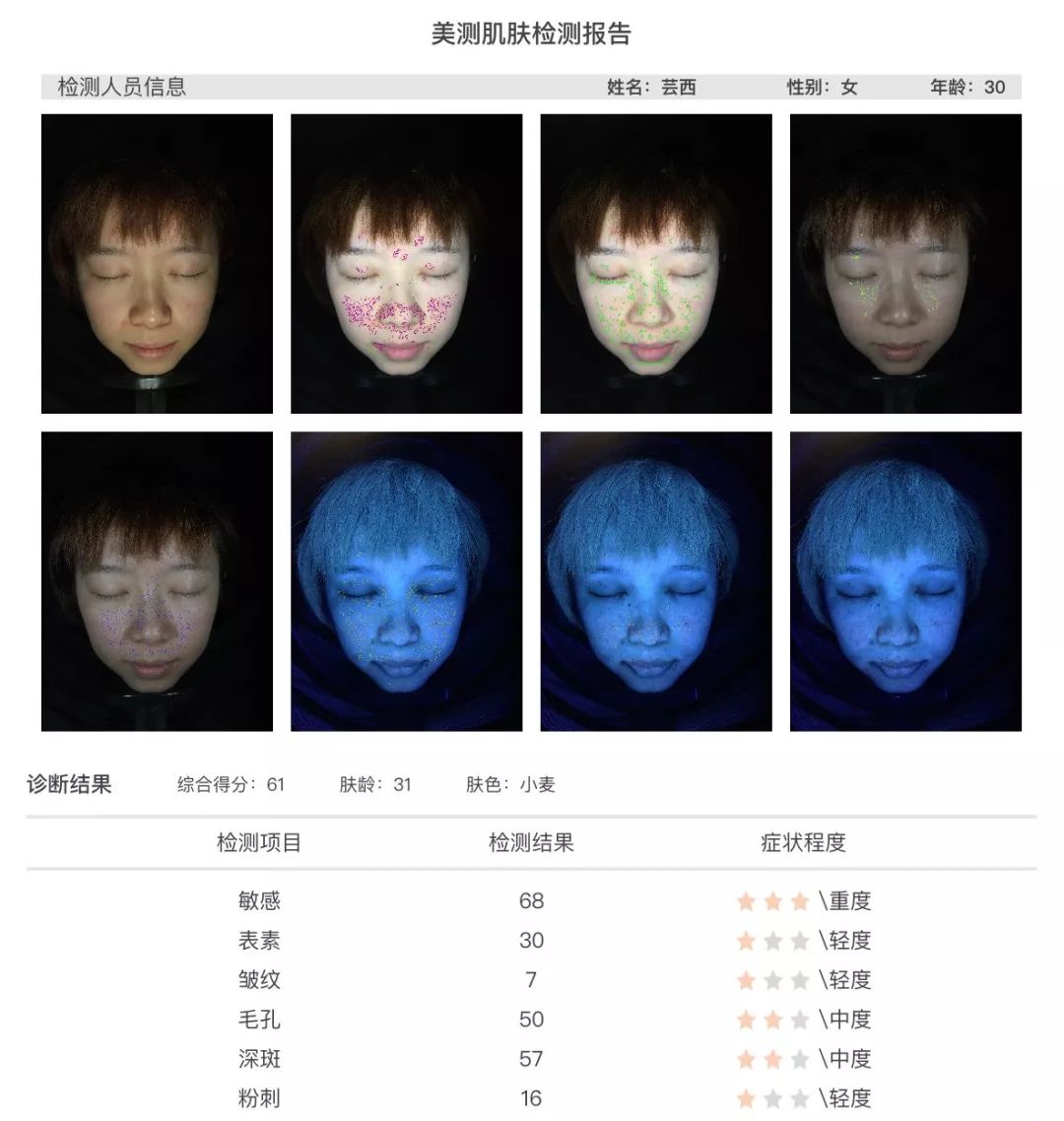 小茂肌诊室∣美容仪挑战：家用美容仪到底值得投资吗？