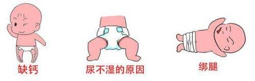 孩子腿型发展不好,小孩腿型发育