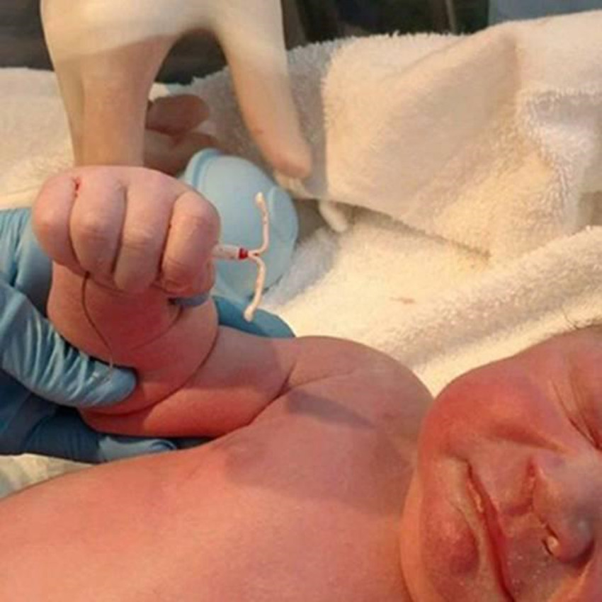 带环会怀孕的宝宝能要不,带环怀孕的孩子到底能要不能要