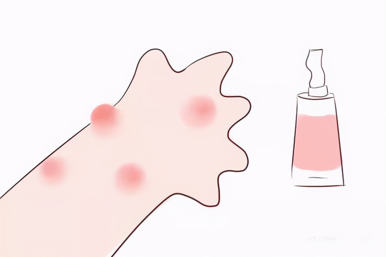 夏天如何防范蜱虫,夏季来临预防4种虫子叮咬