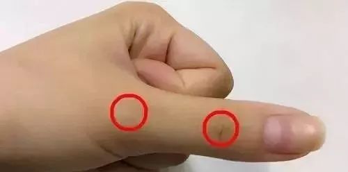 按手指哪个部位可治失眠,刮十指治便秘