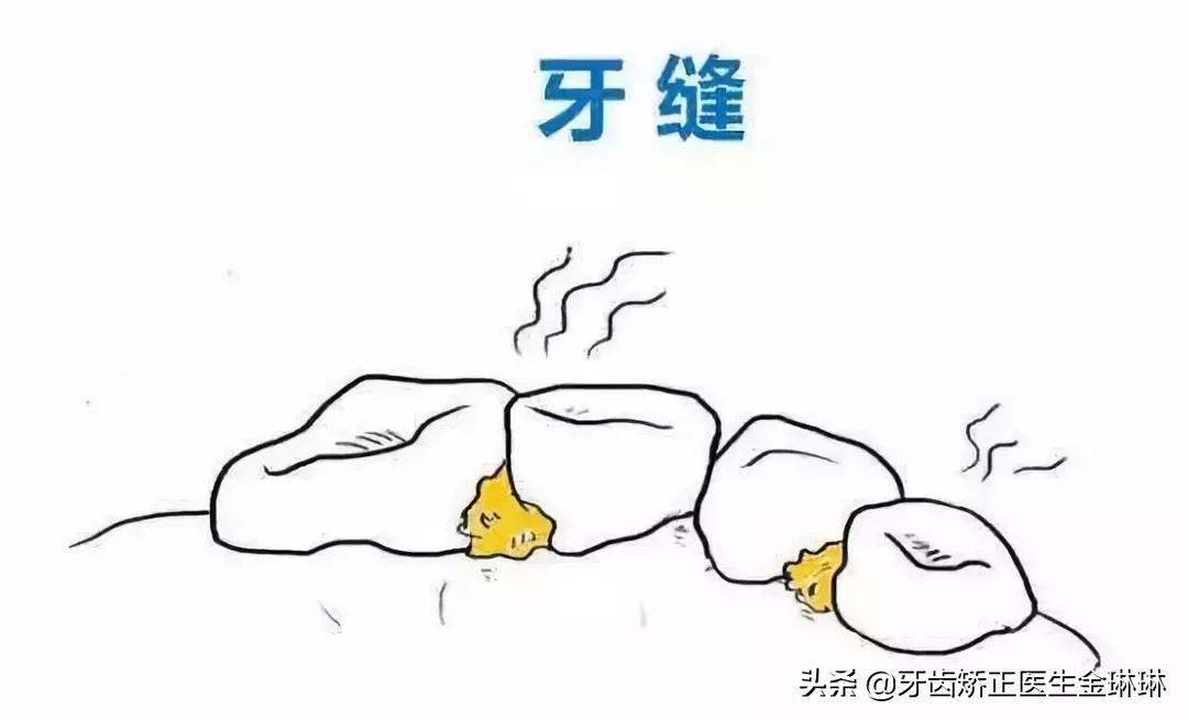 有肾病的人得了牙周炎怎么办,得了牙周炎用什么牙膏刷牙最好