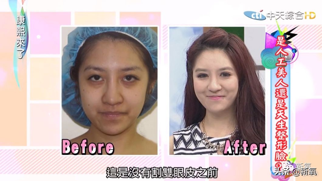 花90万从头整到脚，还可以这么自然？旁边纯天然小姐姐都看懵了