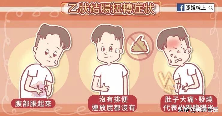 乙状结肠扭转原因,乙状结肠扭转病例