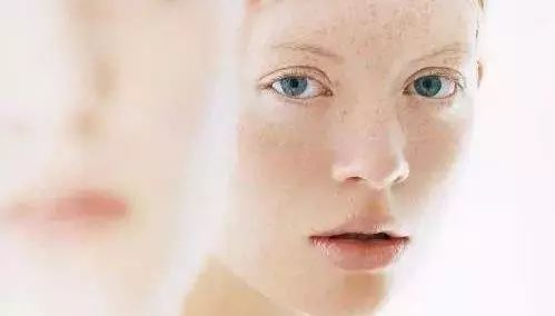 夏季如何远离晒斑,太阳晒斑最好的去除办法