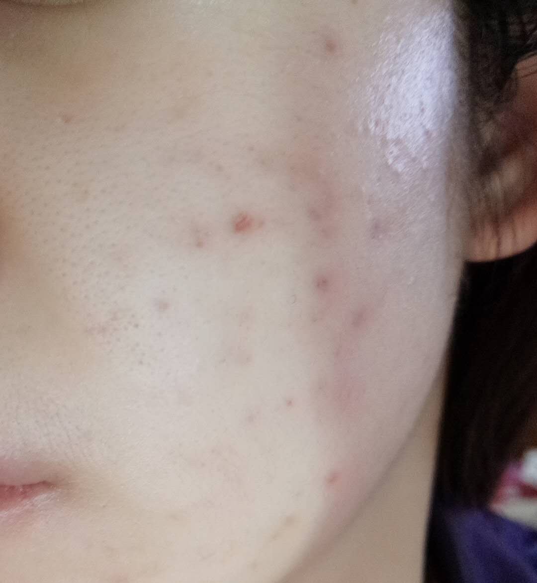 津尔氏薰衣草金缕梅爽肤水怎么样,津尔氏面膜测评