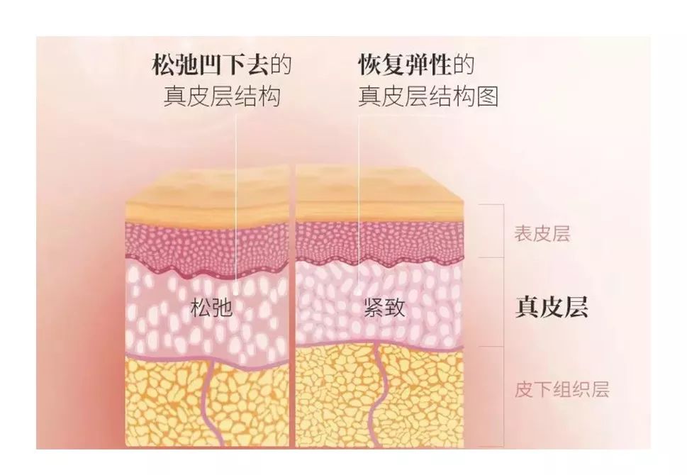 tripollarstop美容仪真假测评,tripollarstopeye测评