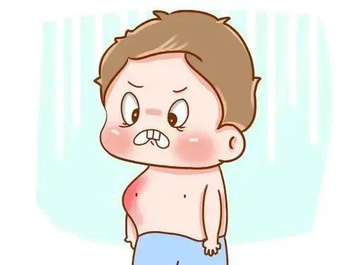 漏斗胸手术后变沟状胸,胸部饱满手术