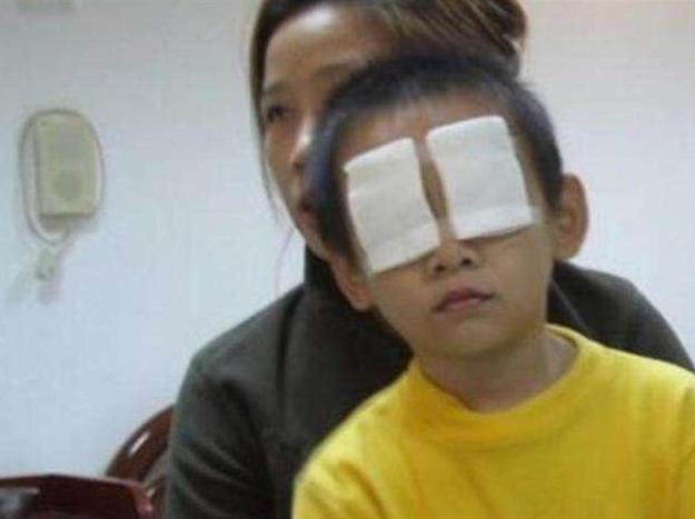宝宝眼睛进灰了怎么办,石灰进入眼睛后失明是永久的吗