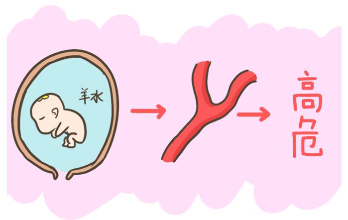 产科危险,产科凶险