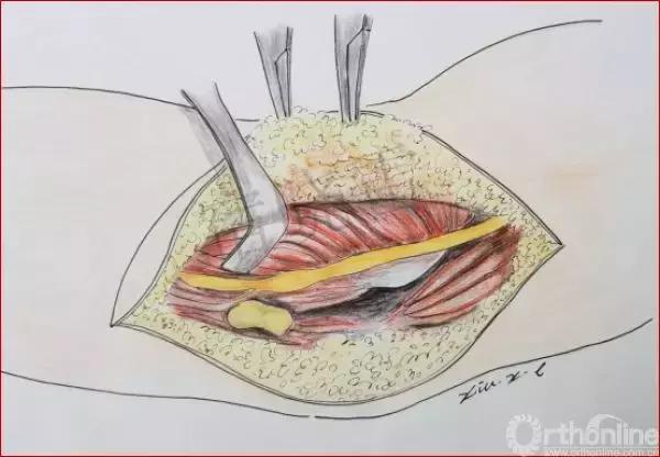 手绘科普视频,手绘类科普