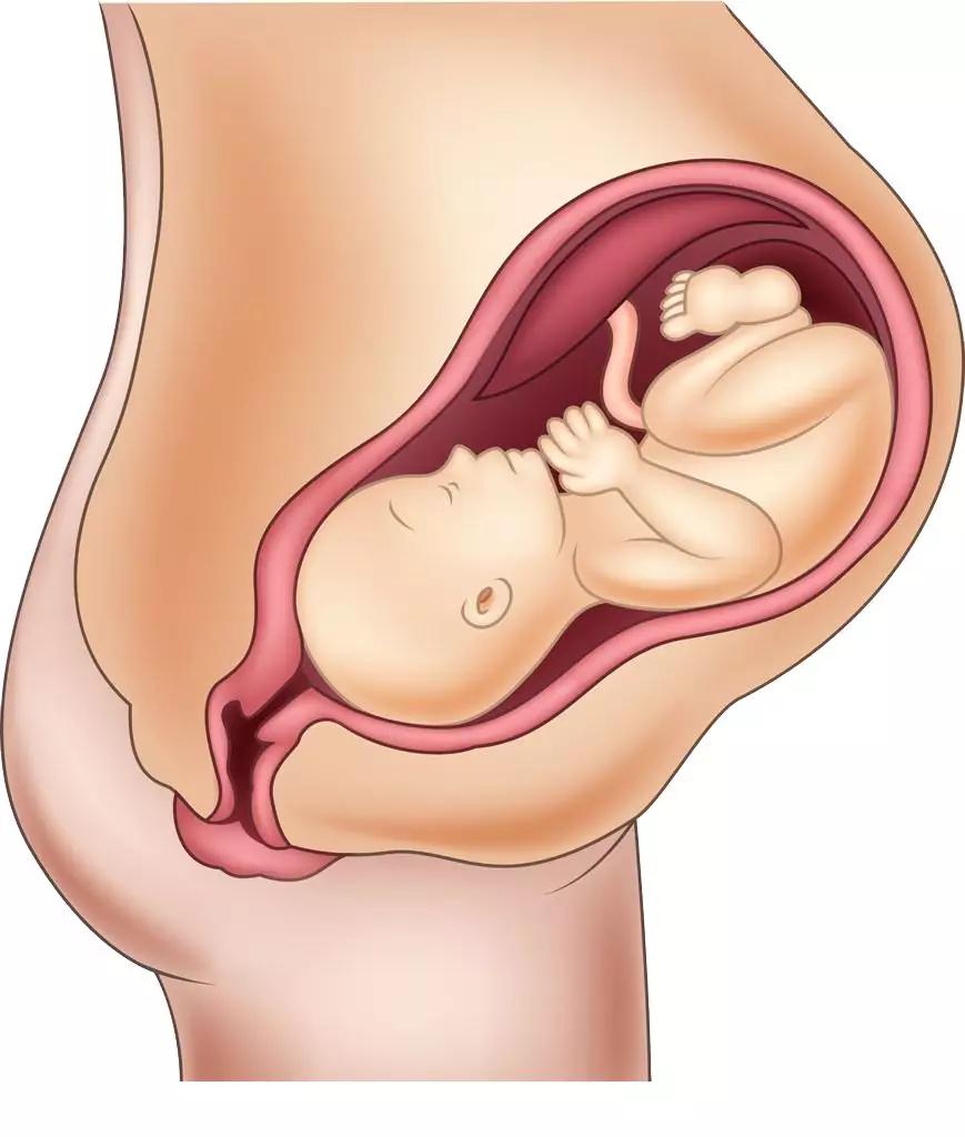 孕期耻骨分离产后怎么恢复,产后耻骨联合分离恢复最佳时间表