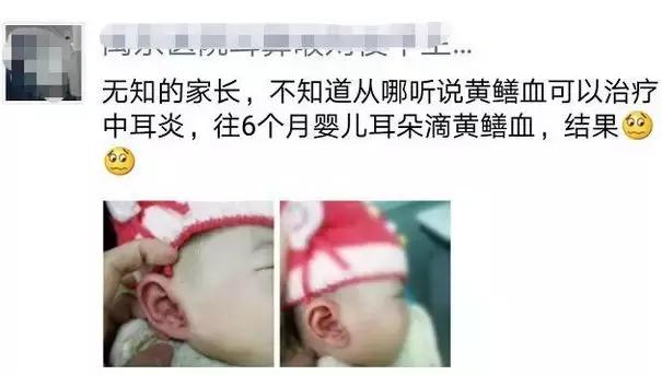 酱油清肠，避孕药洗头，这些自杀式养生为什么总有人信？