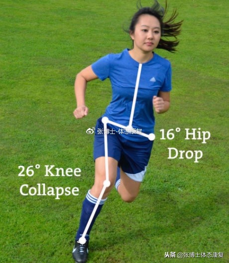 科普前交叉韧带重建术后康复方法,前交叉韧带损伤的保守康复训练