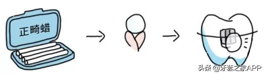 疫情复诊牙套能用吗现在,疫情期间牙齿出现问题怎么办