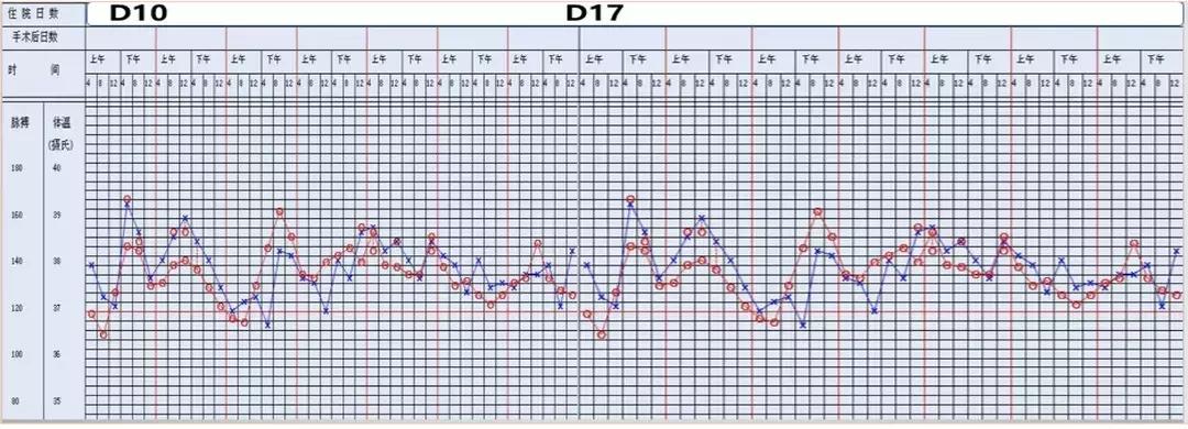 万古霉素治疗mrsa疗程,万古霉素用于mrsa的作用机制
