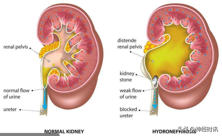 肾脏输尿管膀胱前列腺结构,肾输尿管膀胱解剖示意图