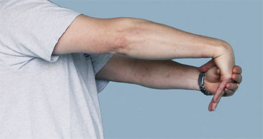 胳膊肘疼俗称网球肘怎么止痛,胳膊肘筋疼不敢伸直挂什么科