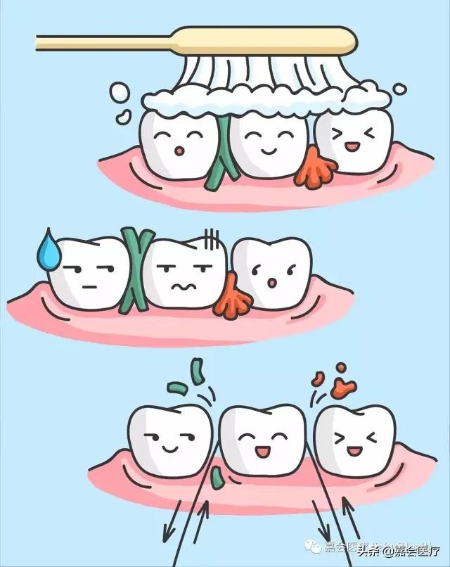 刷完牙用牙线清理牙垢多余吗,刷牙只能清洁70%的牙齿
