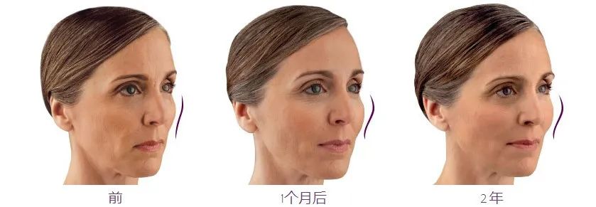 最新最科技的医疗器械,2018最具临床价值创新的医疗器械