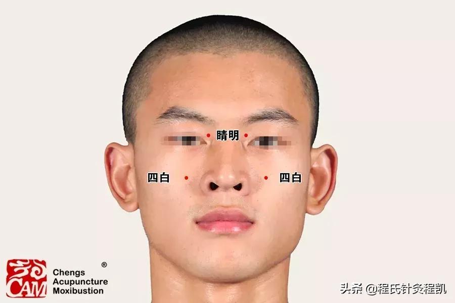 北京同仁医院中医专治干眼症,中医有专治干眼症的药吗