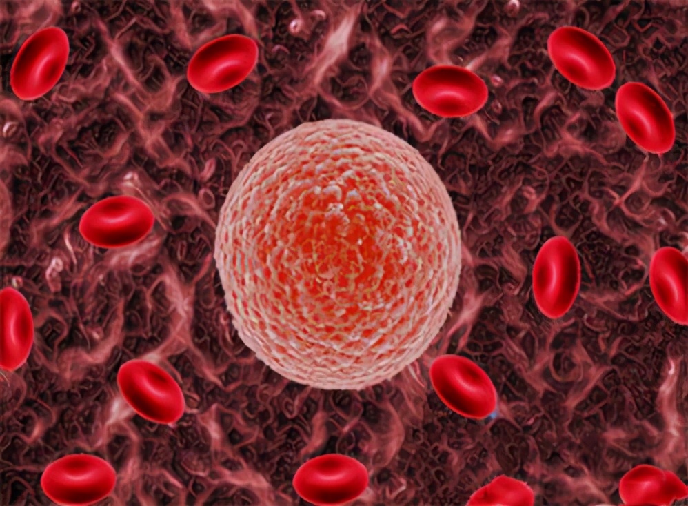 胆红素偏高的原因及危害怎么办,胆红素升高了是怎么回事