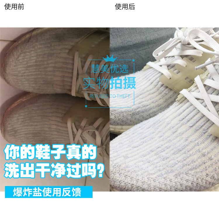 家里发黄的衣服怎么处理,家里衣服泛黄如何才能清洗干净