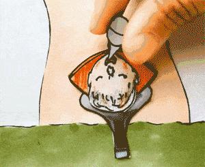 你想剖腹产,为什么医生总劝你自己生?