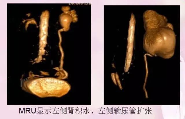 核磁共振能看出来哪些病症,核磁共振可以检查良恶性吗