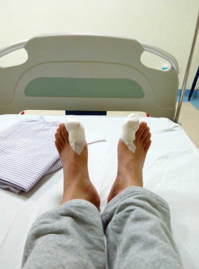 甲沟炎自愈的经历,甲沟炎的亲身经历