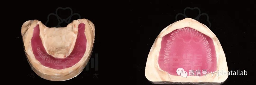 病例教学视频,病例分析操作技能