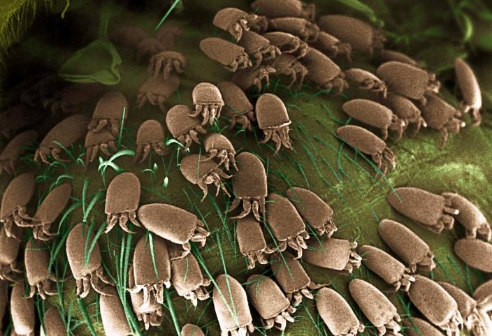 洗澡时搓下来的泥是什么？在显微镜下放大一百倍，看后让人不舒服