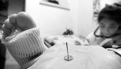 三岁女童手指被压断后续,小孩手指被夹伤需要多久才能恢复