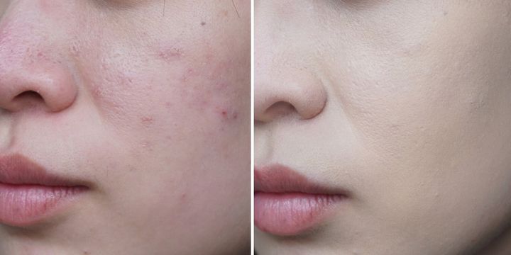 #护肤#气垫兰蔻菁纯气垫好用还是阿玛尼气垫好用？