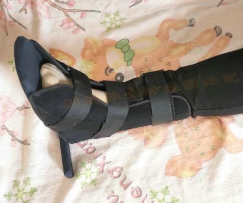 老年人腿粉碎性骨折手术要多少钱,老年人髋骨骨折后一年死亡率