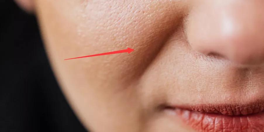 显老的八字纹,什么纹最显老又好看