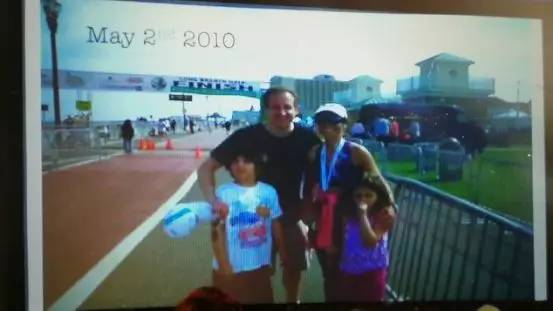 多发性硬化患者分享,多发性硬化的病例分享