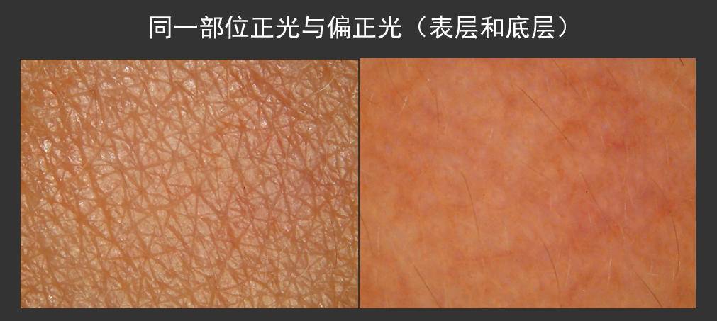 sike美容仪28天实测,30以上的美容仪有哪些