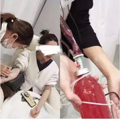 血液净化排毒,血液净化美容有作用吗