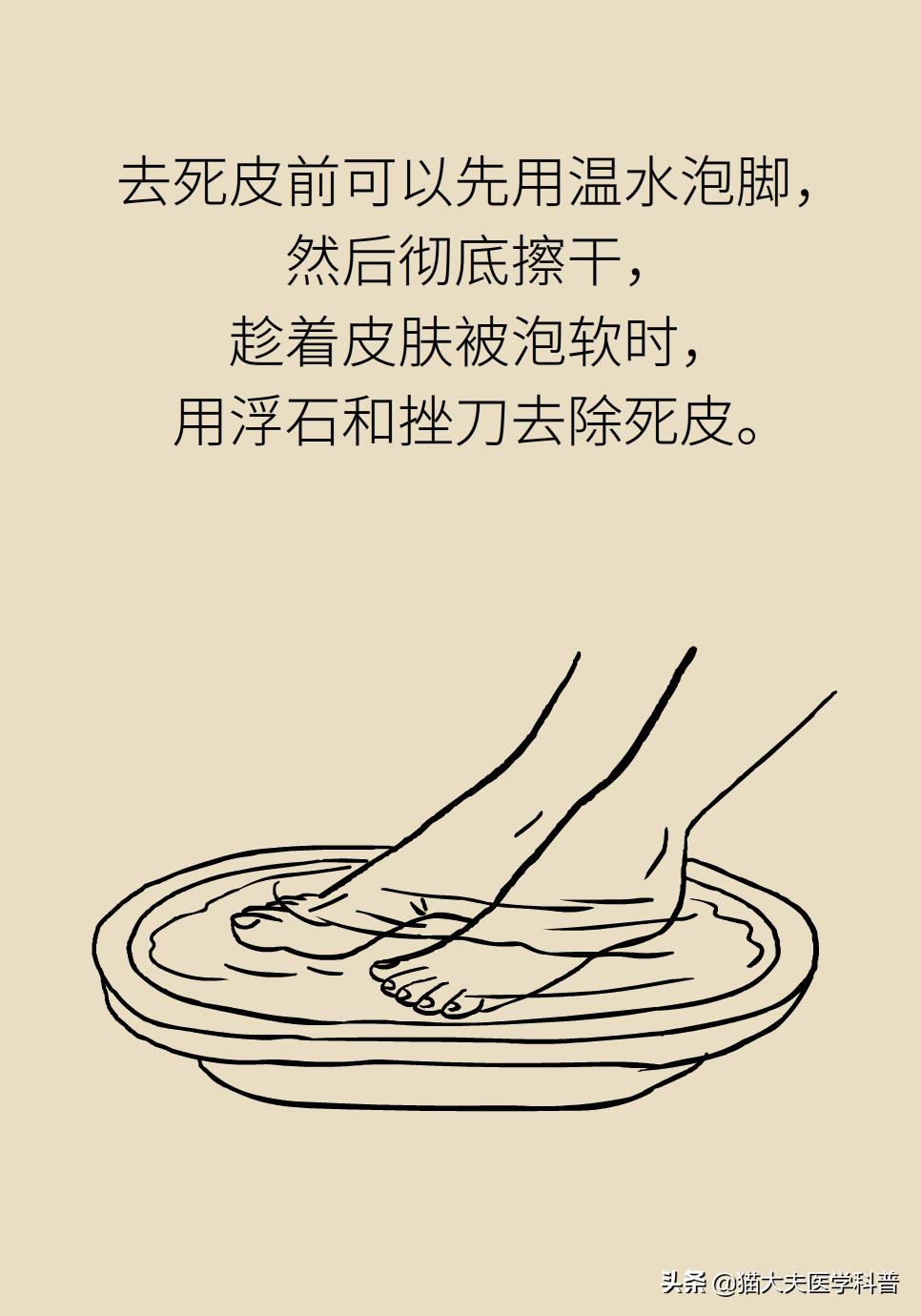 鸡眼好了长了一层老茧,鸡眼与老茧的区别图片