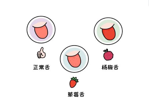 舌头有舌象是什么原因,怎么判断宝宝舌象是否正常