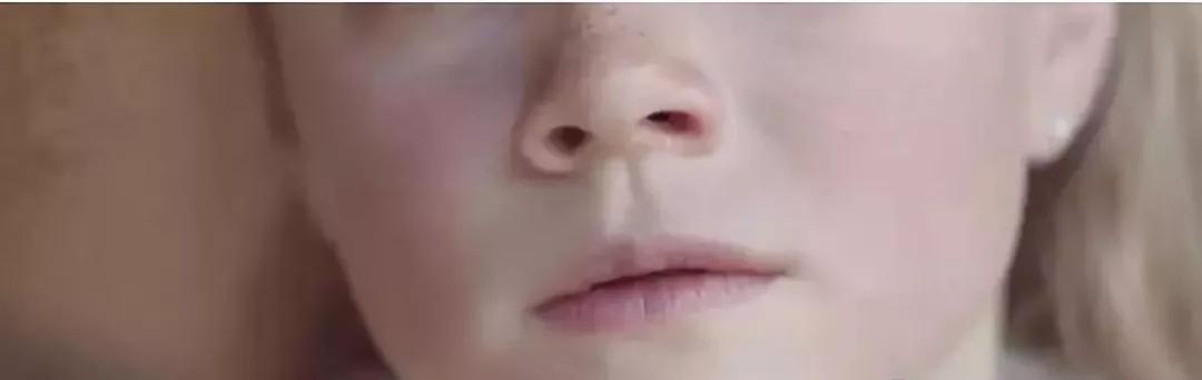 男生脸上的雀斑怎样快速去掉,小孩脸上有雀斑怎样才能去掉